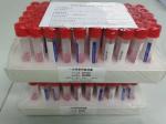 High Quality Hospital Medical Supplies New Crown Vaccine Test Reagent