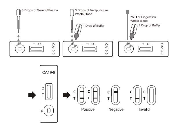 40U/ML 19-9 Carbohydrate Antigen Fast Read Test Kit T199-402