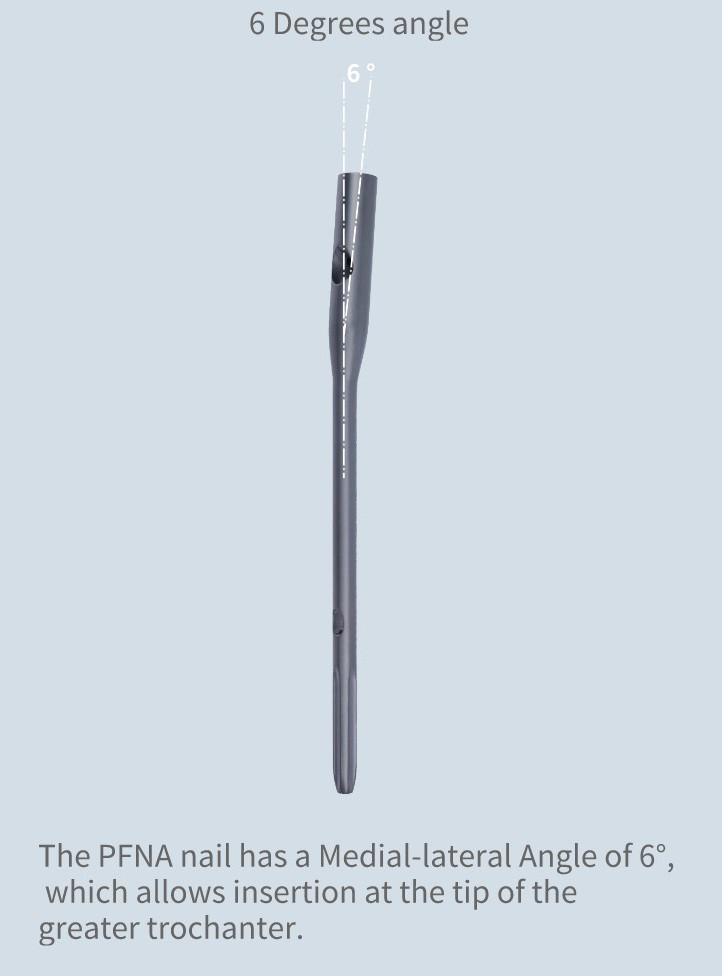 Orthopedic Trauma PFNA Femoral Intramedullary Interlocking Nail