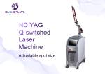 Nd Yag 12ns 7mm 532nm 400m Tattoo Removal Equipment