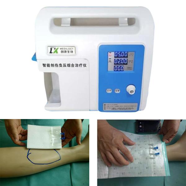 Drainage Negative Pressure Wound Therapy Device Medical DC 14.8V 5000mAh Battery