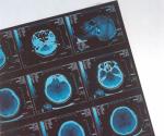 Digital Medical X Ray Dry Film Thermal For Hospital CR / DR