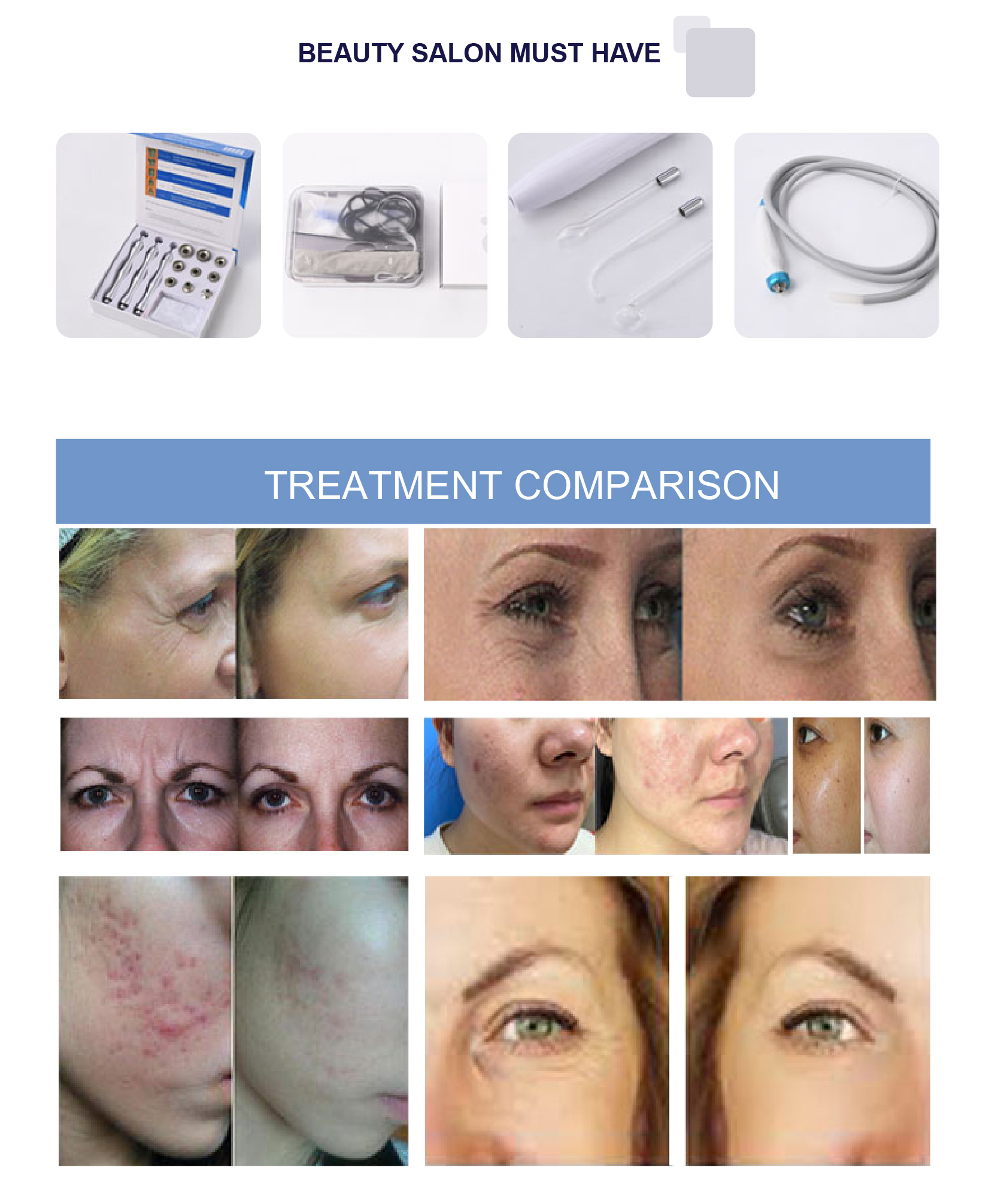 5Mhz RF Frequency Skin Lifting Oxygen Injection Hydra Microdermabrasion Beauty Machine
