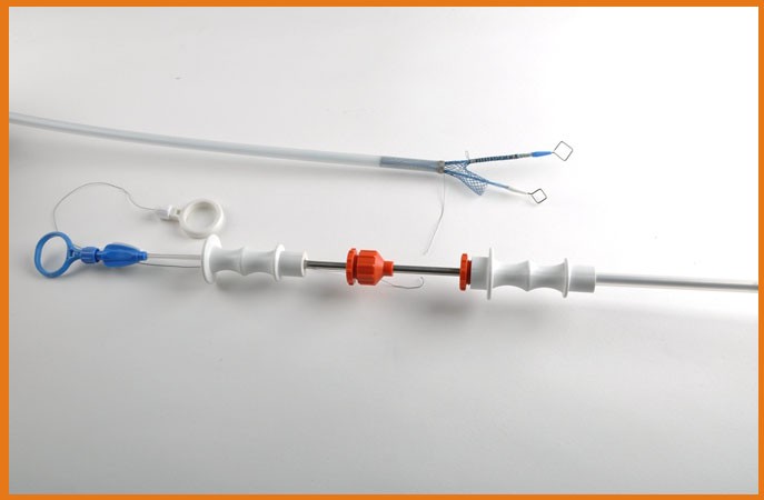 Respiratory Tract Self Expandable Metallic Stent 2mm