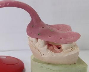 Quality Custom Denture Impression Trays wholesale
