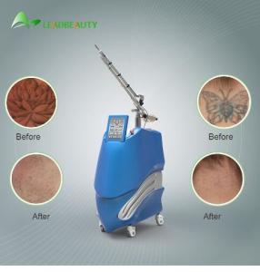 Quality Q-switched 1064nm/532nm PICOSURE laser tattoo removal beauty equipment wholesale