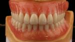 Heat Cured Ivoclar Full Acrylic Denture Dental Lab High Accuracy High Esthetic