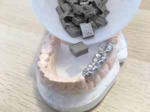 Quality Dental Nickel Based Alloys 220HV10 Hardness Strong Resistance To Traction wholesale