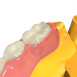 Dental 3d Printing High Strength Mobile Base Biocompatible UV Resin