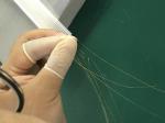 Interventional Medical Device Assembly for OEM Manufacturing