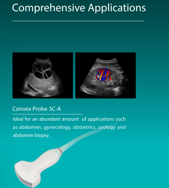 CE approved Sonoscape ultrasound machine Sonoscape X3