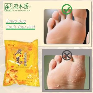 Quality Uncooked Chinese Ginger Foot Soak Stimulate Skin Blood Fatigue Recovery wholesale