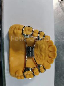 Quality Hygienic Orthodontic Expander Easy To Clean Dental Teeth Retainer Adjustable Design wholesale