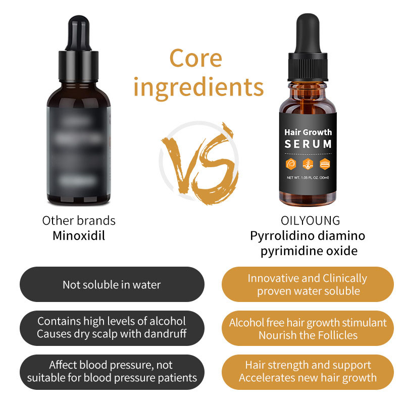 Anti Loss And Hair Regrowth Hair Oil Treatment With Natural Ginger Extract 30ml Customized