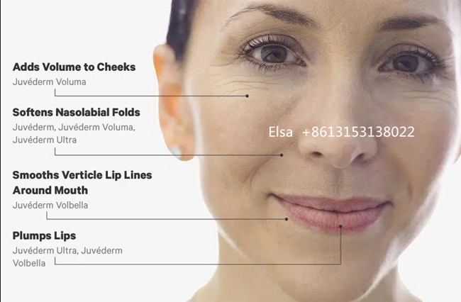 Juvederm Voluma Injectable Dermal Filler 2*1ml 24mg HA Dermal filler