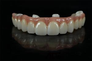 Quality Precise Dental Implants Crowns And Bridges Custom Abutment wholesale