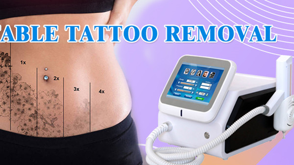 Medical Nd YAG Hair Removal Machine 1064nm 532nm Laser Tattoo Removal Equipment