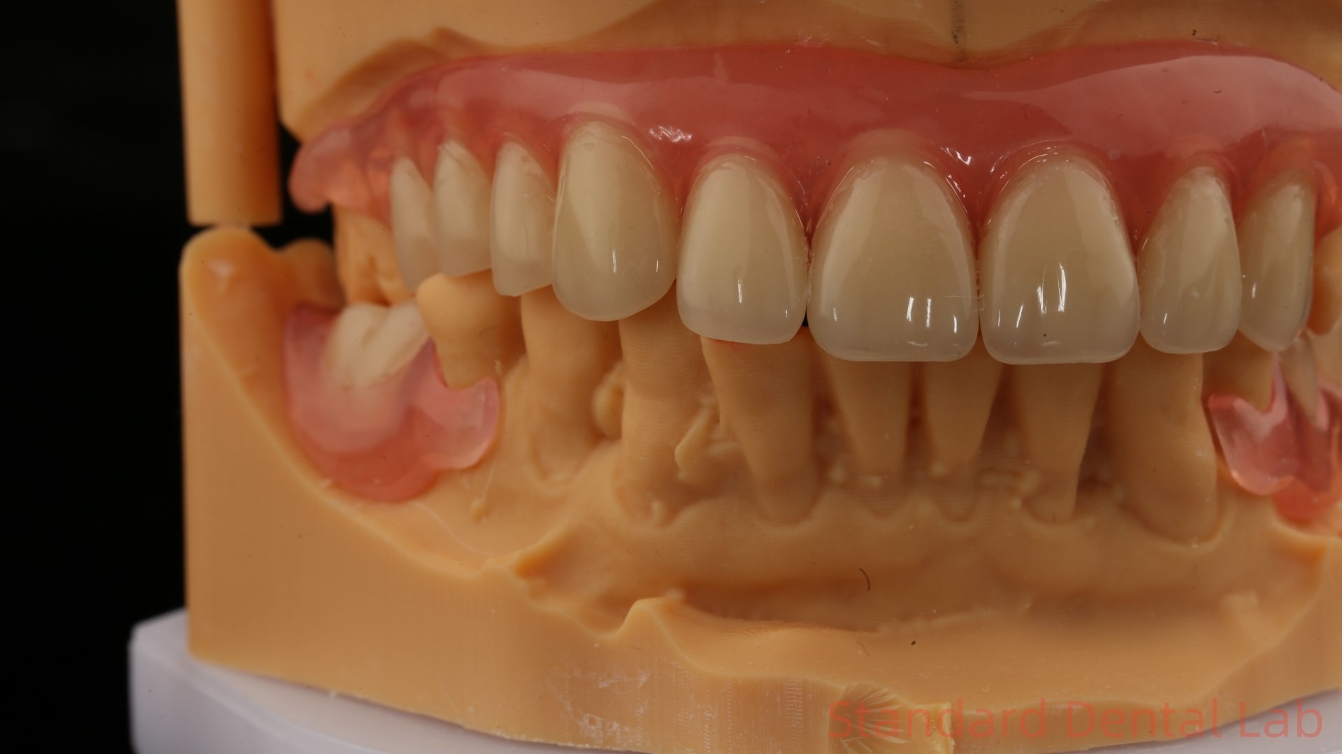 3D Print Model Dental TCS Valplast Flexible Partial Dentures Pink / Dark Color Dental Lab Product