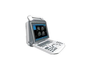 Quality SUCE-I50 12.1'' Digital Ultrasound machine wholesale