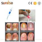 980nm diode laser for lipolysios/ nail fungus removal/vascular removal