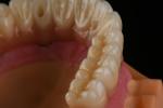 Roughened Surface Titanium Dental Implants Surgery For Front Tooth Replacement