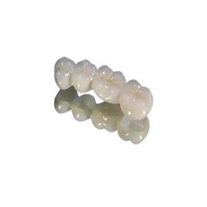 Quality Composite Fixed Bridge Crown Confident Beautiful Crowns And Bridges wholesale