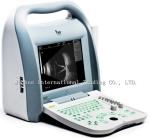 best selling ab scan a cheap ophthalmic ultrasound Eye machine