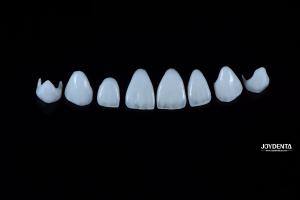 Quality 0.3-0.5mm Thick Natural Porcelain Emax Veneers High Strength Long Lasting For Aesthetics wholesale