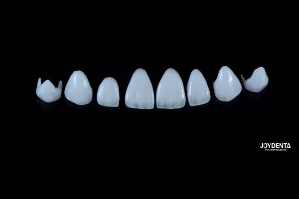 0.3-0.5mm Thick Natural Porcelain Emax Veneers High Strength Long Lasting For