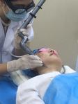 Wrinkle Remover Beauty Equipment Scanning Fractional Co2 Laser Machine