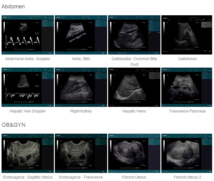 DUS 60 new compact ultrasound system