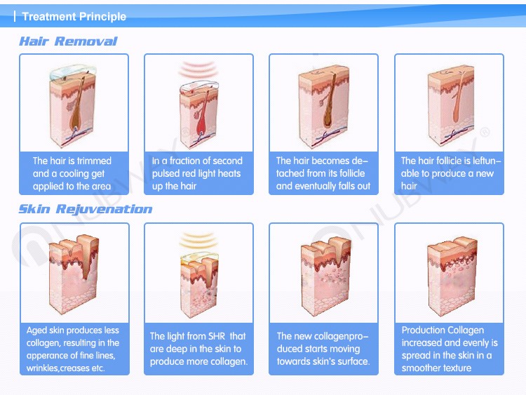 CE/FDA approved 2000W 2 handles skin rejuvenation 3 in 1  elight  ipl shr hair removal machine