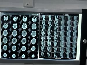 Quality Density Enhanced Diagnostic Laser X Ray Film 0.28D For Medical Equipments wholesale