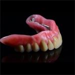 CAM Milled Titanium Bar Dental Implant Hybrid Prosthesis Dentures