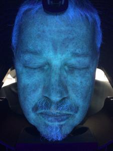 Quality Skin Scanner Diagnosis Machine , 3d Uv Skin Analysis wholesale