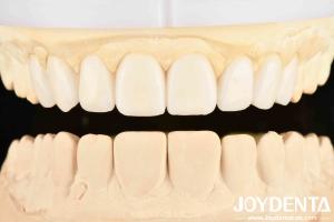 Quality Experience the Difference with Dental's Good Elasticity and Tooth Arrangement Technology in Dental Care wholesale