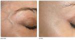 arm laser EQUIPMENT
