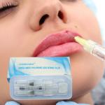 Dermal Lip Fillers Removing Fine Wrinkles
