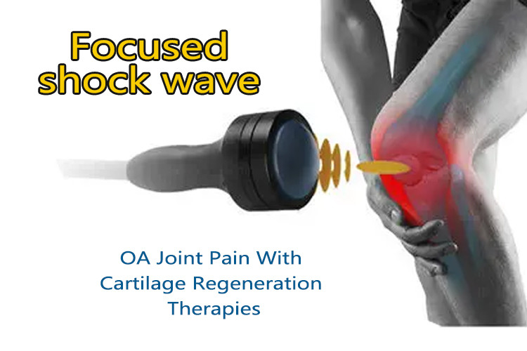 Professional Eswt Shock Wave Machine Eswt Shockwave Therapy Machine Erectile Dysfunction Treatment