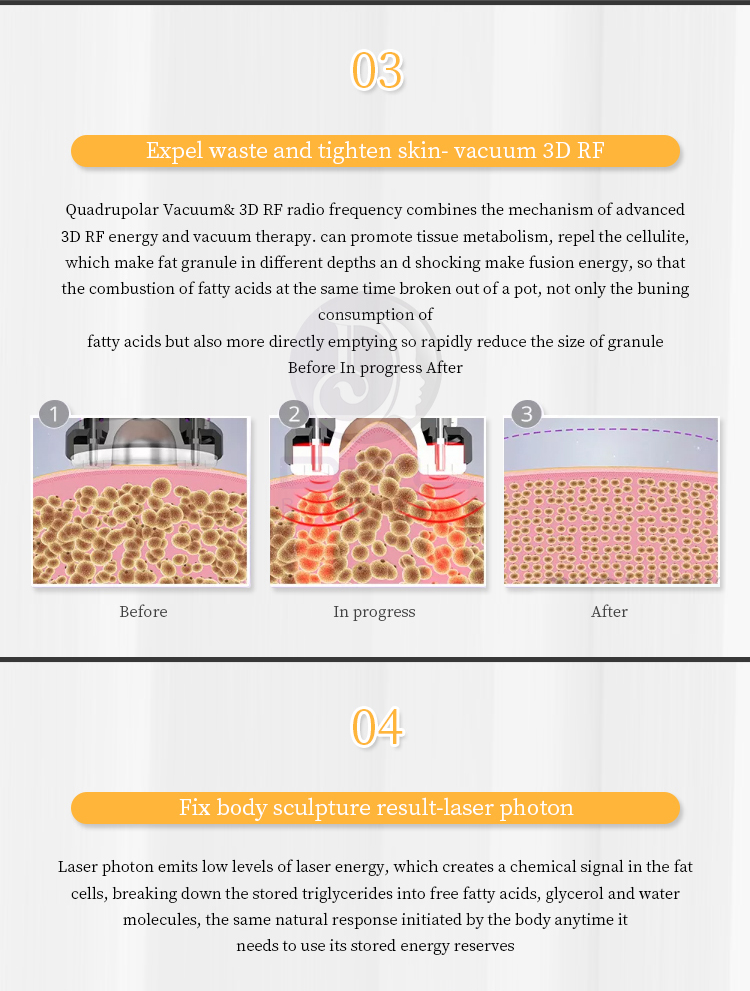 Guangdong Laser Technology DPL Popular latest s-shape cavitation 40 et 80 et radiofrquence slimming machine lipocavitation