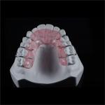 ODM Modified Hawley Removable Retainer Post Orthodontic Appliance
