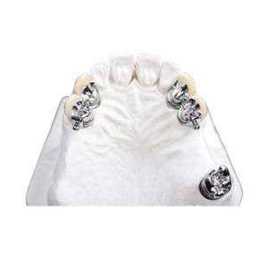 Quality Easy Clean OEM Precision Attachment Partial Denture Stain Resistant wholesale