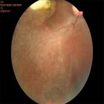 35mm Fundus Imaging System Equipment Auto Focus Shooting