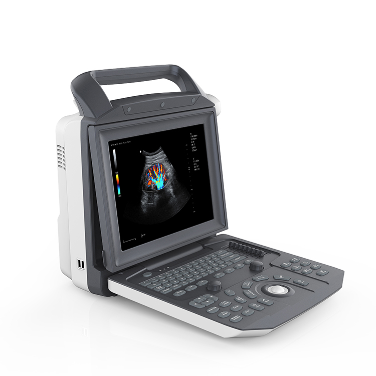 Portable Full Digital Color Doppler Ultrasound System Medical Scanner Ultrasound