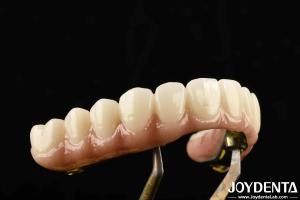 Quality Durable Ti-Bar Zirconia Hybrid Bridge Made Of Titanium And Zirconia Materials For Heavy Us wholesale