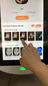 China Magic Mirror Portable Skin Analyzer Sd Card Save For Doctor Skin Clinic on sale