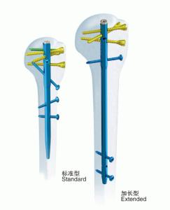 Quality Surgical Orthopedics Anatomic Humerus Interlocking Nail wholesale
