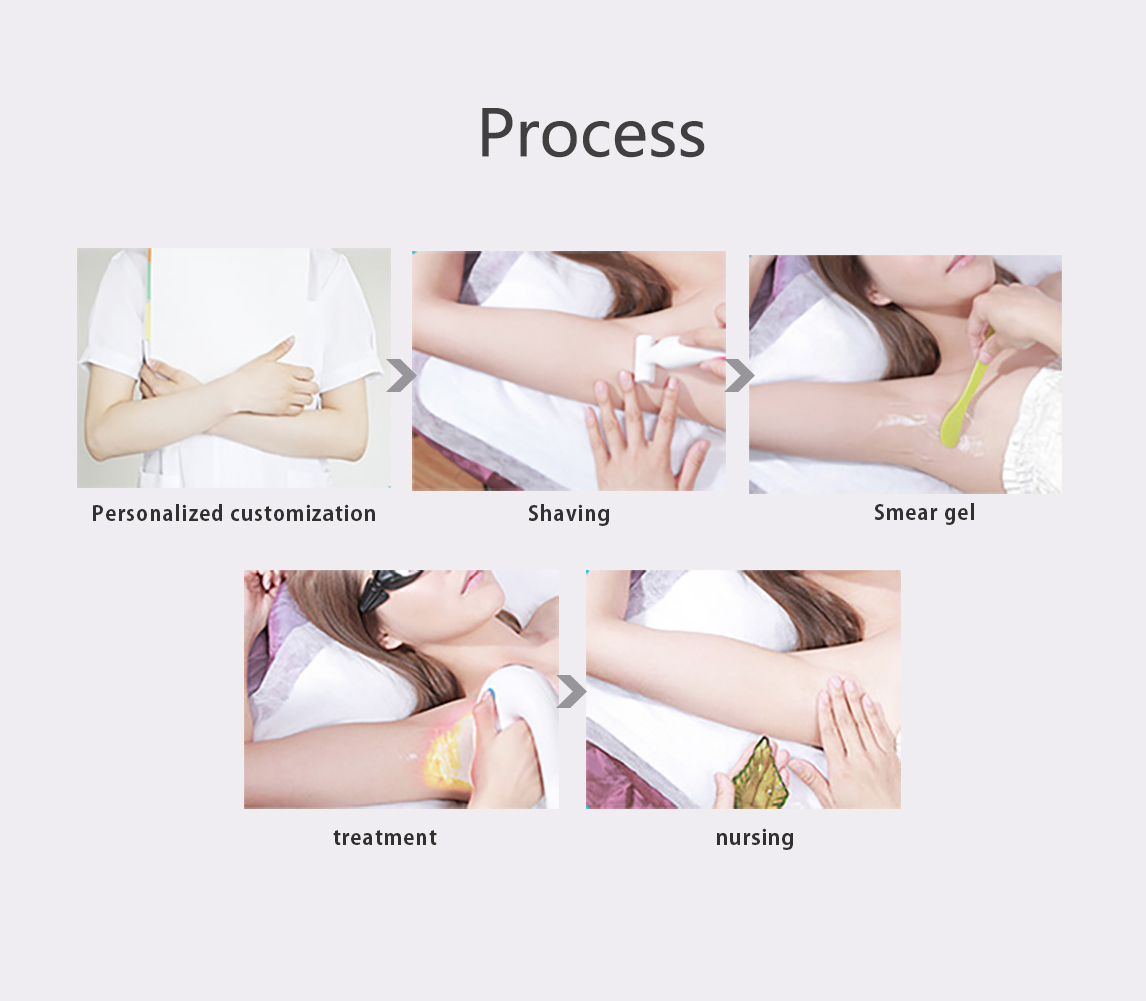 3 Wavelength 755/808/1064nm Diode Laser Body Hair Removal Machine for Skin Type I-VI