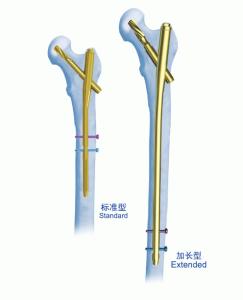 Quality PFNA CE Gamma Nail Fixation Interlocking Nail wholesale