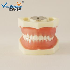 Quality Peridontal Disease Teeth Study Model Human Dental Model Gingival Diseases wholesale